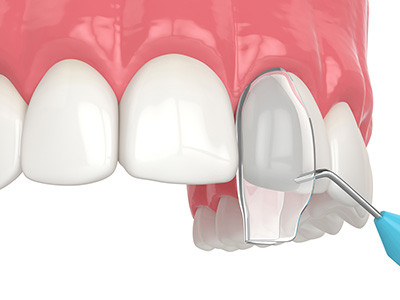 Mirage Dental Associates