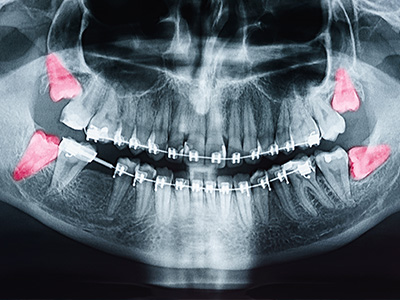 Mirage Dental Associates