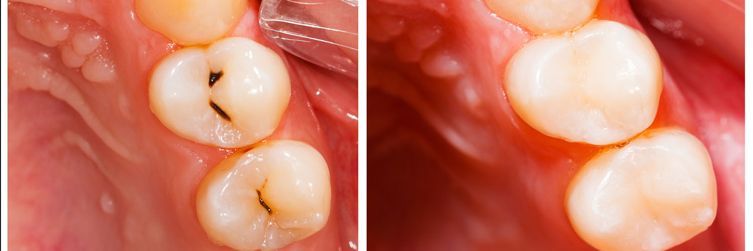 Mirage Dental Associates